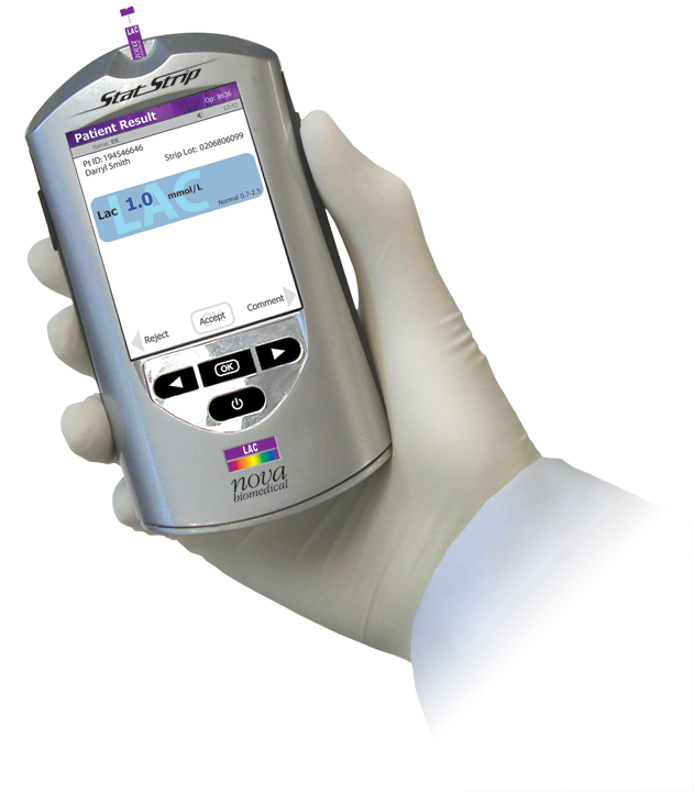 StatStrip® Lactate Connectivity Meter 